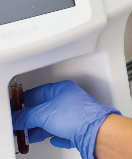 Affordable Blood Cell Counter Affordable Blood Cell Counter