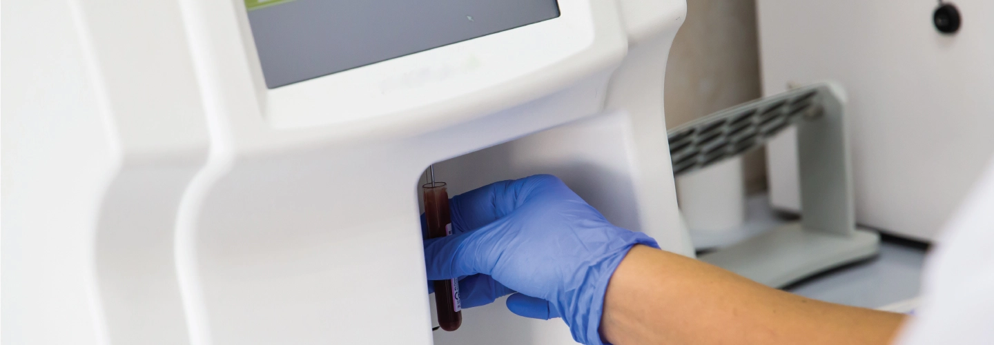 Affordable Blood Cell Counter
