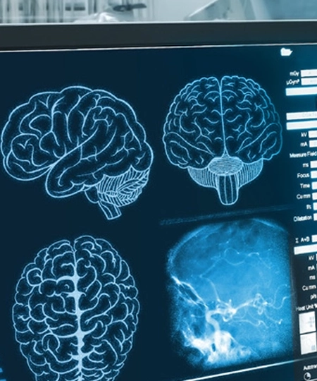 AI-Driven Transformations in Medical Imaging