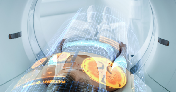 Leveraging AI in Oncology: A Transformative Approach - LTTS